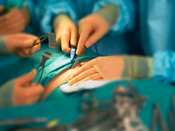 8 cirugías cosméticas que terminaron mal - En cirugía, 2 x 1 puede ser mortal